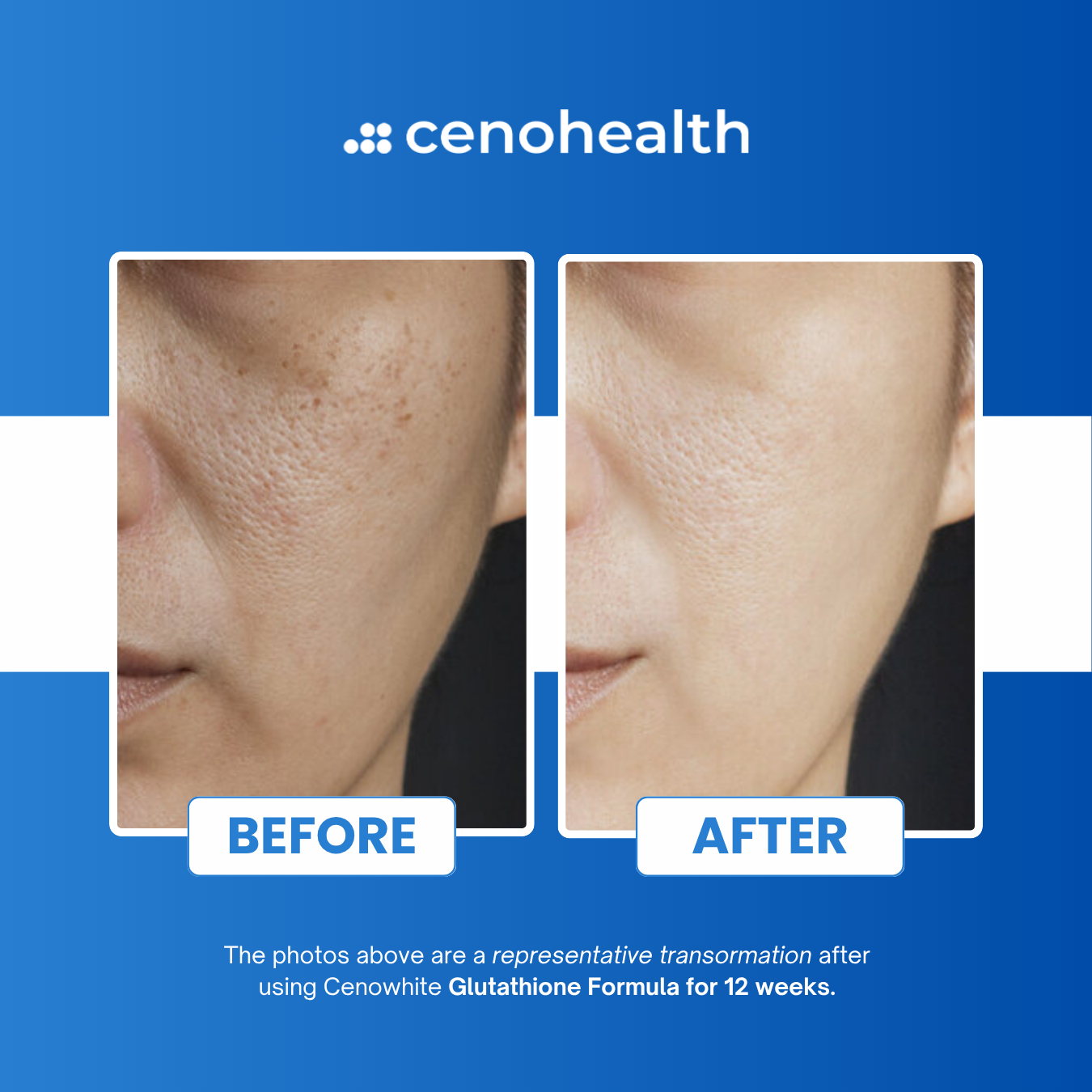 CENO Pure Glutathione Whitening
