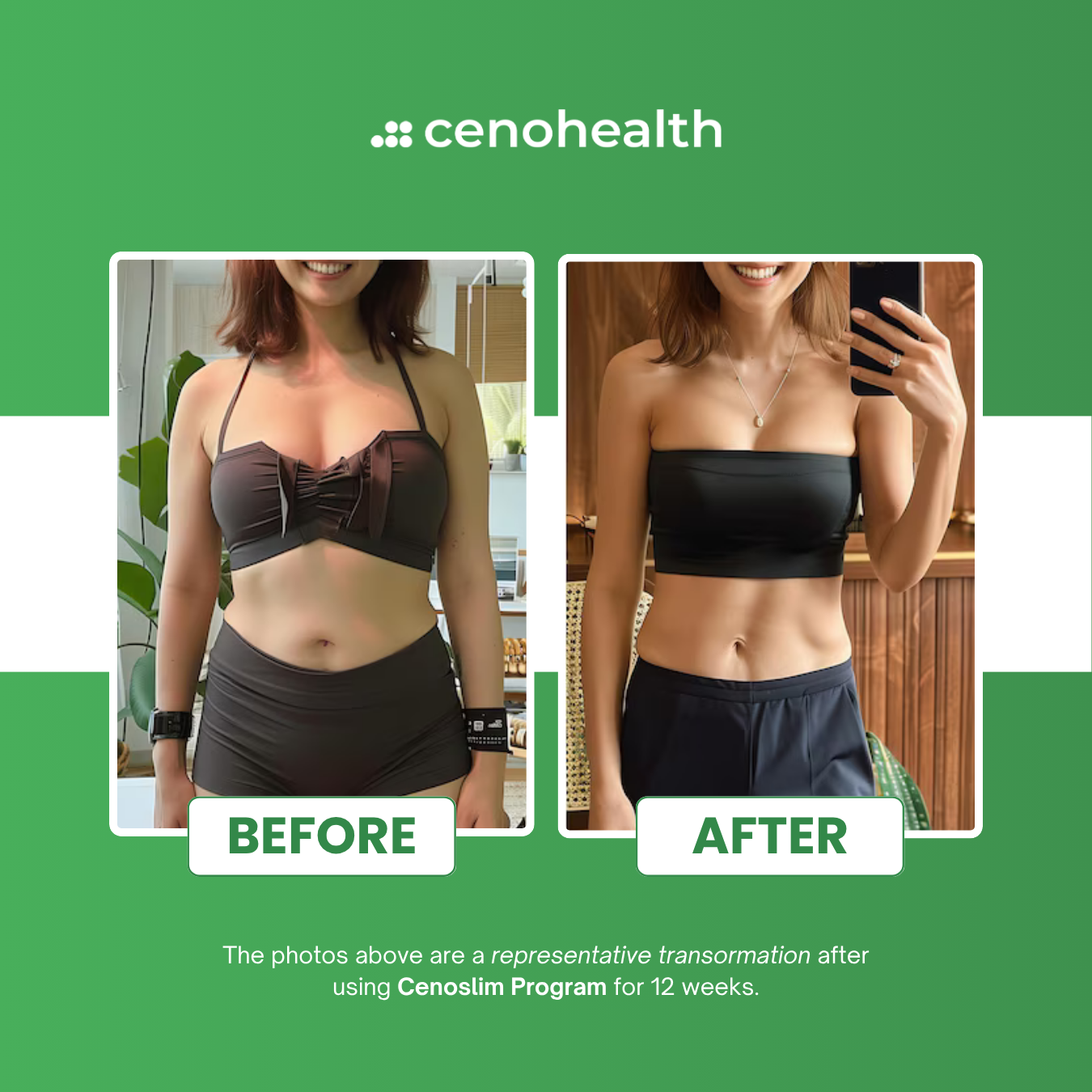 Cenoslim Slimming + Whitening Garcinia Cambogia with Glutathione